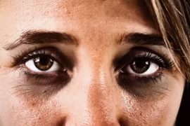 4 thứ này thâm đen... dễ mắc bệnh nguy hiểm, có 1 cũng nên đi khám