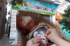 Trẻ mầm non bị nhét giẻ ở Thái Bình: Bộ GD&ĐT yêu cầu xử nghiêm