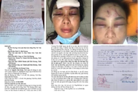 Hải Dương: Đang xác minh vợ tố chồng chích điện, dìm xuống ao