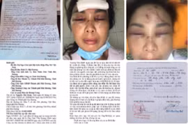 Hải Dương: Đang xác minh vợ tố chồng chích điện, dìm xuống ao