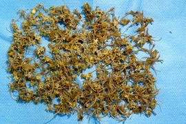 Nam bệnh nhân bị tắc ruột do nuốt hàng ngàn mảnh xương rắn