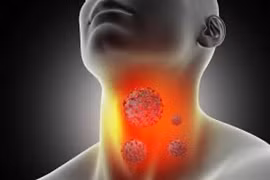 Phương pháp mới điều trị hiệu quả ung thư vòm họng