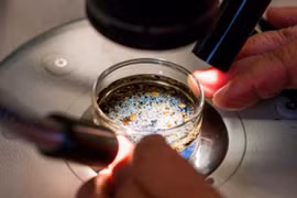 Phát hiện vi nhựa trong dịch nang buồng trứng 