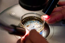 Phát hiện vi nhựa trong dịch nang buồng trứng 