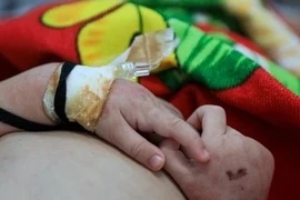 Cao Bằng: Bé 2 tuổi tử vong nghi do mắc sởi