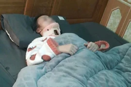 Thanh Hoá: Đình chỉ học 1 năm 4 nữ sinh đánh bạn gãy đốt sống cổ