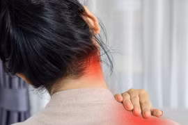 Vì sao nhiều người trẻ mắc chứng đau cổ vai gáy?