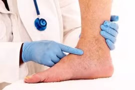 Chế độ dinh dưỡng cho người bệnh huyết khối tĩnh mạch sâu