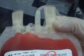 Kỹ thuật mới: phát hiện HIV trong 11 ngày 