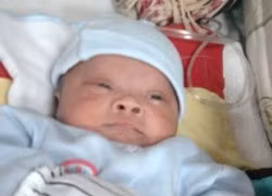 Cứu sống trẻ sơ sinh mắc bệnh phổi hiếm gặp