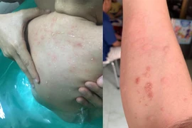 Cấp nước Trung An nói gì về việc nước máy chung cư Prosper Plaza vàng?