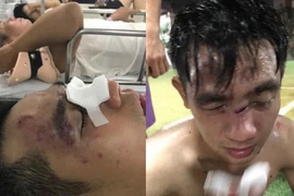 Cả đội bóng ở Hà Nội bị đánh tơi bời vì thắng đối thủ quá nhiều 