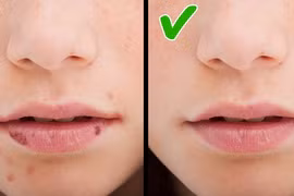 Cơ thể có những dấu hiệu này cần bổ sung vitamin ngay tức thì