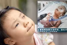 Thương tâm bé gái mù 2 mắt vì ung thư