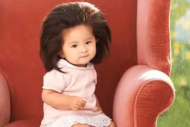 Kỳ lạ những em bé sơ sinh có mái tóc dài như bờm sư tử