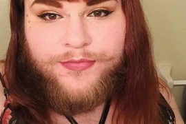 Khuôn mặt gây sốc của cô gái vài tháng không cạo râu