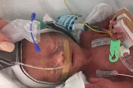 Sự hồi sinh kỳ diệu của bé gái sinh non