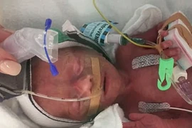 Sự hồi sinh kỳ diệu của bé gái sinh non