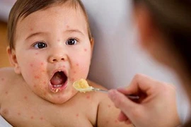 Trẻ bị chân tay miệng nên ăn những món gì tốt cho sức khỏe