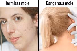 Hạn chế 10 thói quen làm đẹp này kẻo hối hận khi về già