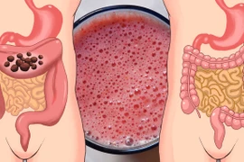 7 cách an toàn làm sạch đại tràng, ngừa bệnh tật