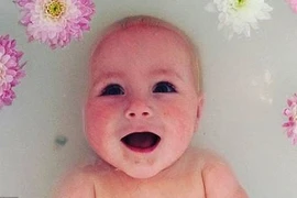 Bất ngờ cách chữa bệnh chàm da cho con của người mẹ Anh