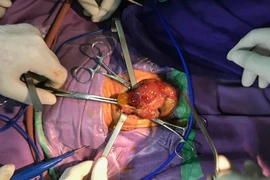 BV Sản Nhi Quảng Ninh phẫu thuật cứu sống bé sơ sinh 16 ngày tuổi 