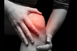 Chữa khỏi đau đầu gối hiệu quả tại nhà bằng chanh, gừng...