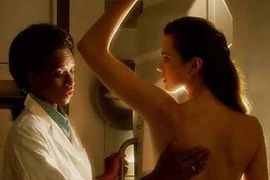 Nghiên cứu: Nhiều phụ nữ trẻ tử vong do ung thư vú