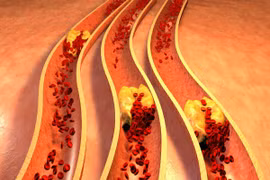 Những sự thật về cholesterol không phải ai cũng biết