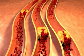 Những sự thật về cholesterol không phải ai cũng biết