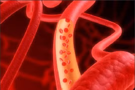 8 thực phẩm tăng cường lưu thông máu, ngăn ngừa đột quỵ