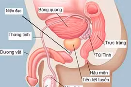 Nam giới càng lớn tuổi, càng dễ mắc ung thư tiền liệt tuyến