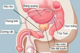 Nam giới càng lớn tuổi, càng dễ mắc ung thư tiền liệt tuyến