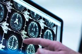 10 dấu hiệu ung thư sớm nhiều người thường chủ quan