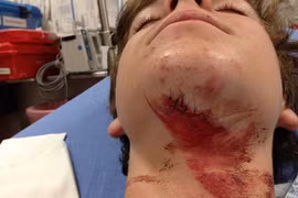 Kỳ lạ chàng trai được cứu sống nhờ vụ tai nạn giao thông