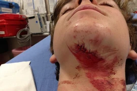 Kỳ lạ chàng trai được cứu sống nhờ vụ tai nạn giao thông