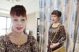 Cô dâu Thu Sao 62 tuổi lại khoe ảnh sau phẫu thuật bị lệch mặt