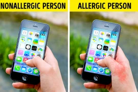 11 vật dụng quen thuộc hàng ngày có thể âm thầm khiến bạn dị ứng