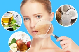 Bỏ túi những mẹo hay làm dịu da cháy nắng 