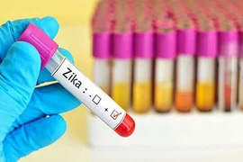 TP.HCM: Đã có 29 ca nhiễm Zika