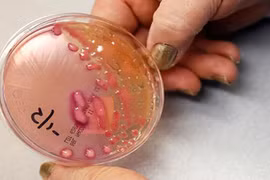 Cực hiếm bệnh nhân chết vì kháng tất cả loại kháng sinh 