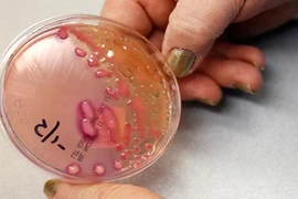 Cực hiếm bệnh nhân chết vì kháng tất cả loại kháng sinh 