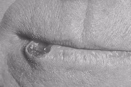 Cảnh giác dấu hiệu ung thư nếu từng quan hệ đường miệng