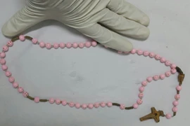 Phát hiện chuỗi hạt gần 1m trong thực quản cụ bà 73 tuổi 