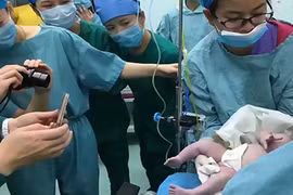 Cận cảnh ca đỡ đẻ "tốn người" nhất cho sản phụ 140kg