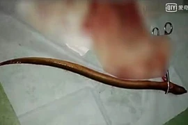 Cho lươn chui hậu môn chữa táo bón và cái kết đắng