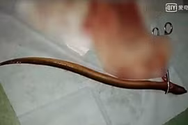 Cho lươn chui hậu môn chữa táo bón và cái kết đắng