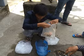 Phẫu thuật ghép tay cho nam thanh niên bị côn đồ chém