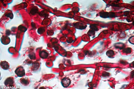 Cảnh báo về chủng nấm men kháng thuốc có thể gây chết người